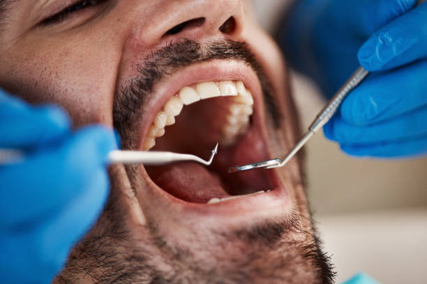 Best Emergency Gum Pain Relief  in Alanes Ridge, CA